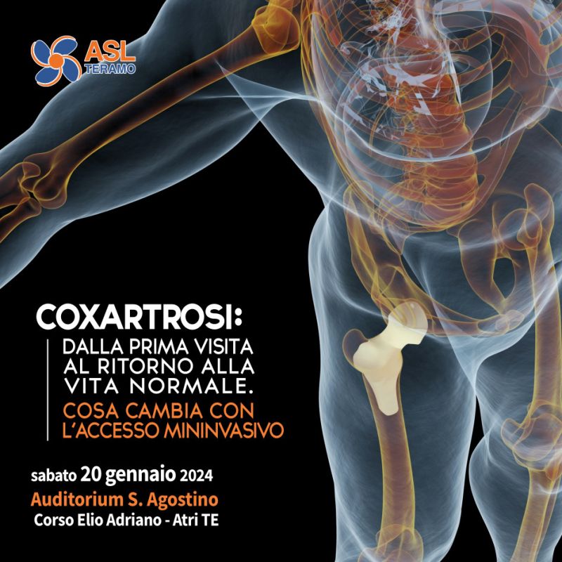 Coxartrosi: dalla prima visita al ritorno alla vita normale. Cosa cambia con l’accesso mininvasivo - 20 gennaio 2024 Atri